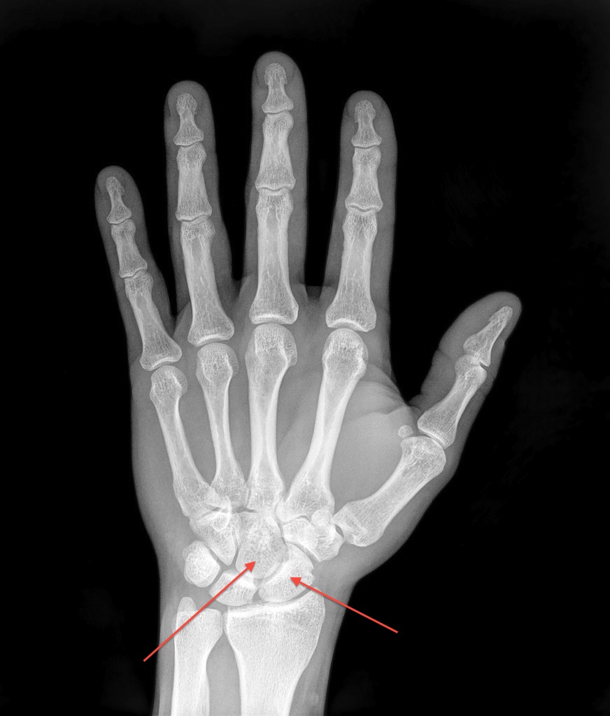 Anatomical Snuff Box Usmle / Jump to navigation jump to search. Musicis